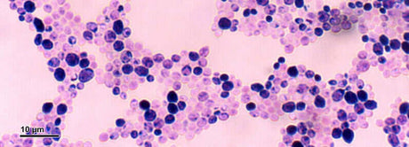 Candida albicans - levures